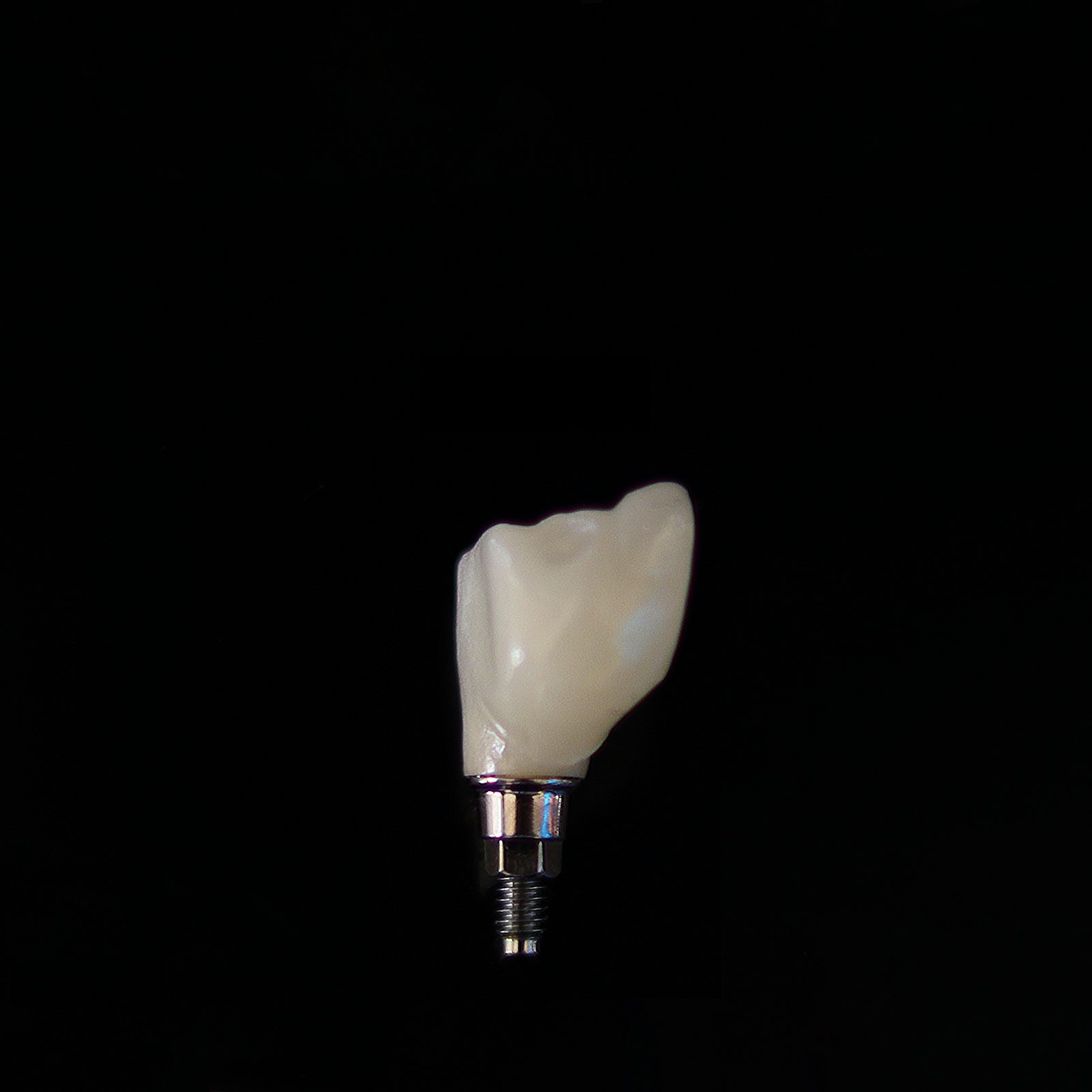 Implante dentário com coroa cerâmica